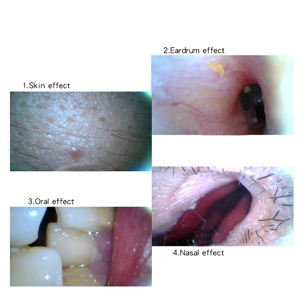 Низкая Температура WI-FI эндоскопа 5,5 мм объектив Ухо Нос медицинские USB эндоскопа бороскоп инспекции отоскоп Камера для IOS Android ПК