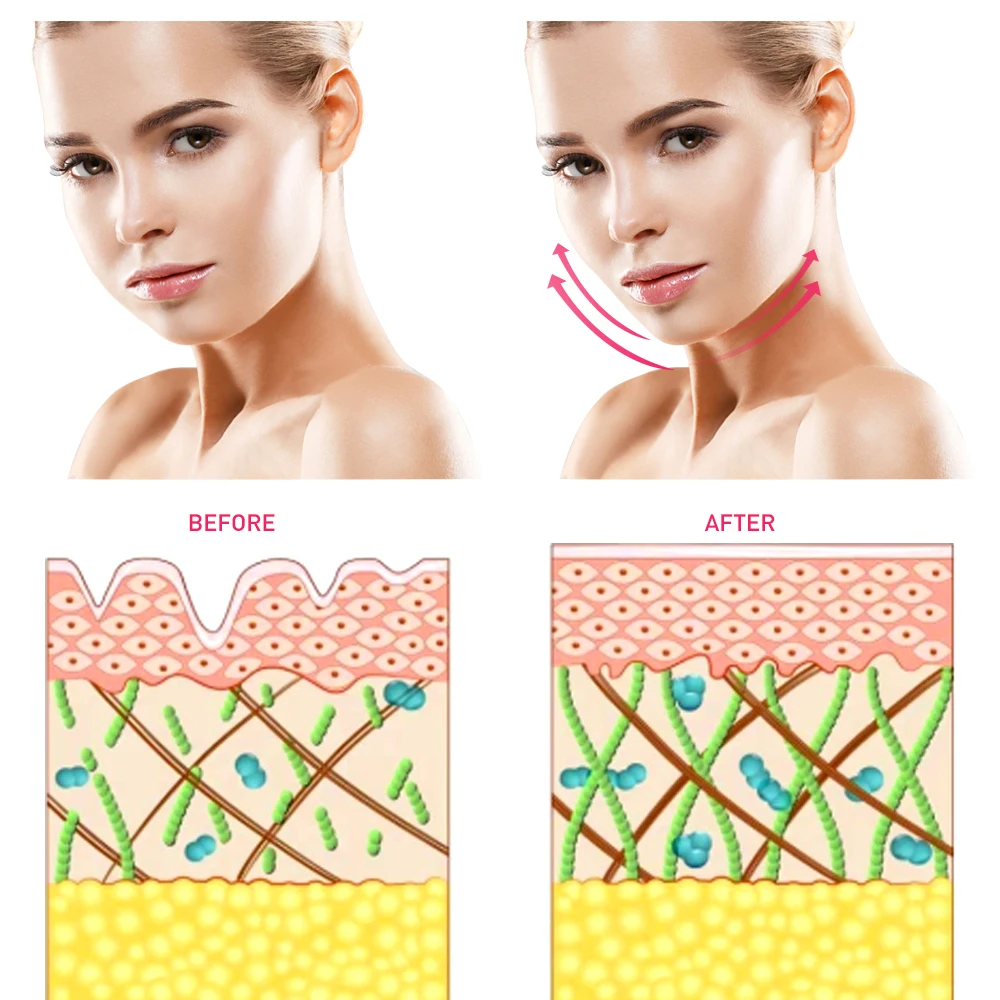  Mini Microcurrent Face Lift Machine Multifunction Beauty Device Skin Tightening Facial Wrinkle Blac