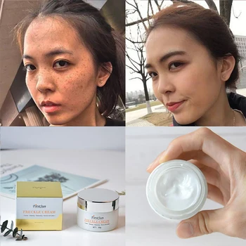 

Firstsun Strong Effects Powerful Whitening Freckle Cream 30g Remove Melasma Acne Spots Pigment Melanin Face Care Cream TSLM1