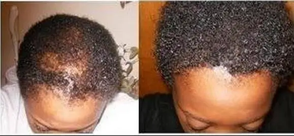 Beli Jamaican hitam Minyak jarak dengan Rosemary 4 oz (gratis botol)