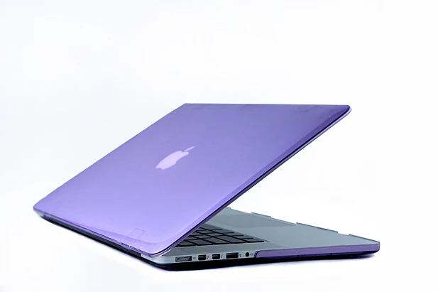 Retina