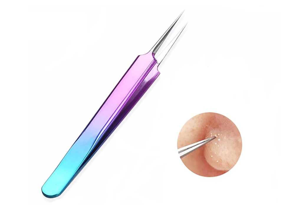 Acne tweezers (2)