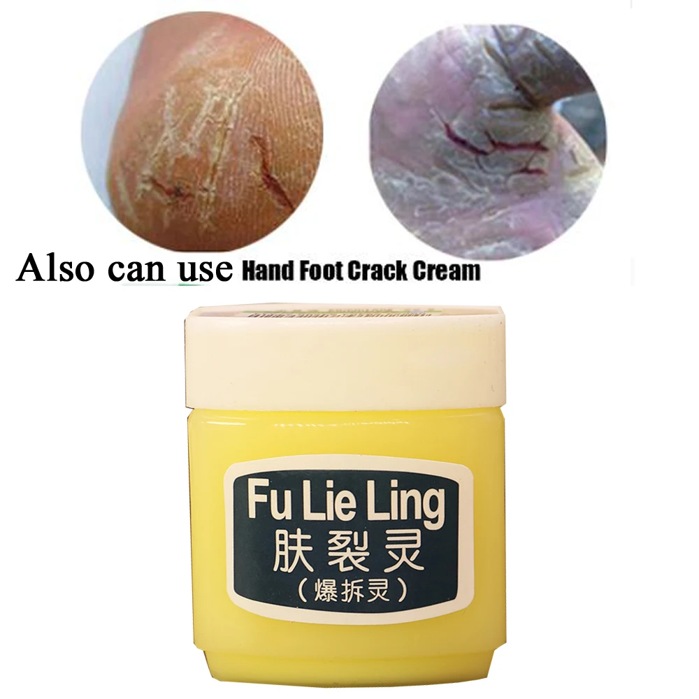 

Natural Cure Face Cream Prevent Skin From Crowfoot Cracks Moisturize Face Skin Frost Crack Prevention For The Winter Dry Skin