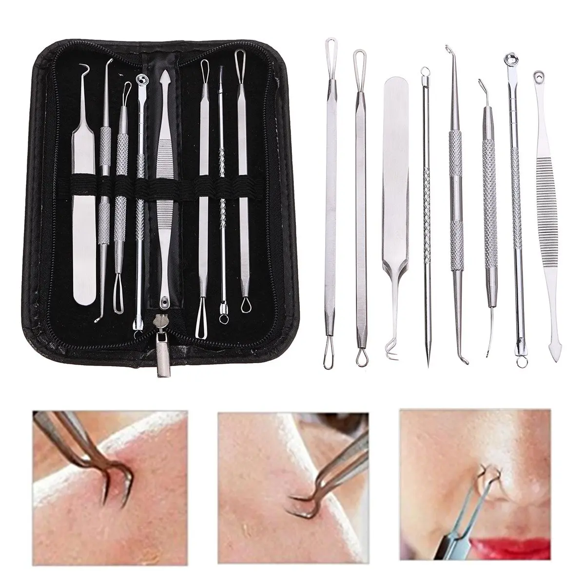 

8pcs Blackhead Remover Tool Kit Stainless Steel Pimple Acne Comedone Needle Tweezer Blemish Whitehead Extractor Face Skin Care