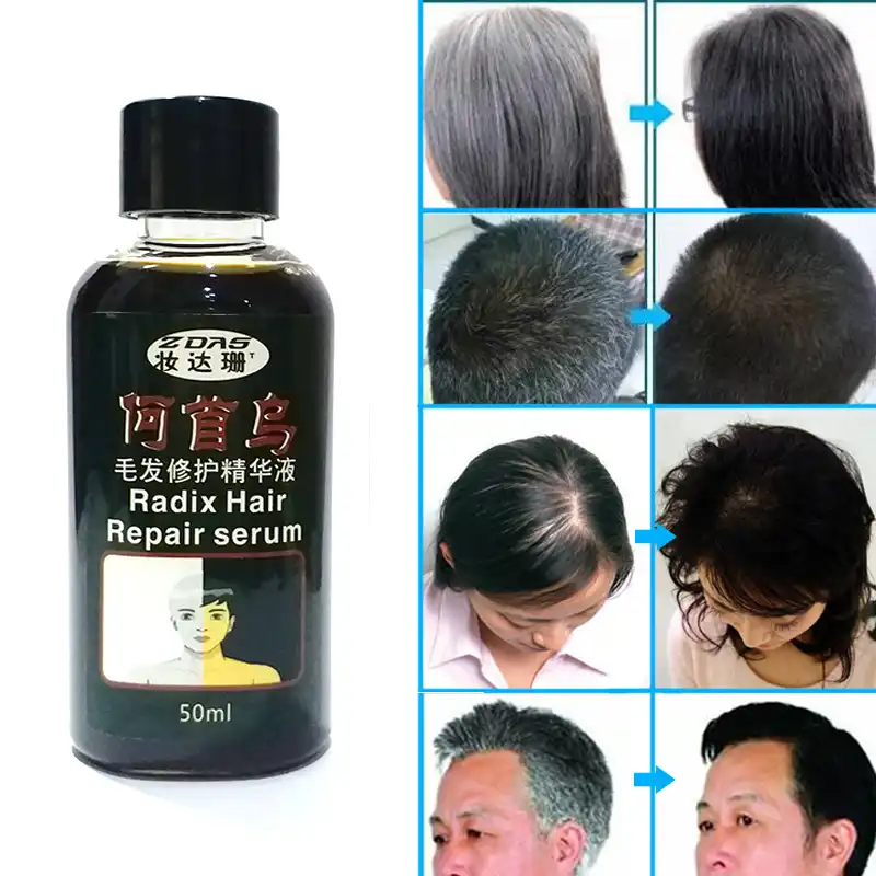 Traditional Chinese Medicine Cure White Hair Turn Gray Black