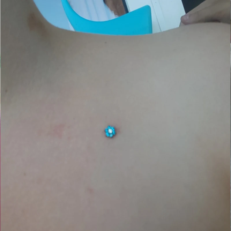 -6