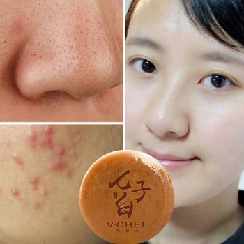 

New Chinese Medicine Seven White Face Soap Cleanser Blackhead Removal Blemish Treatment Skin Care