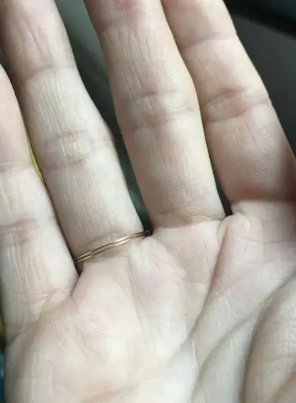 99