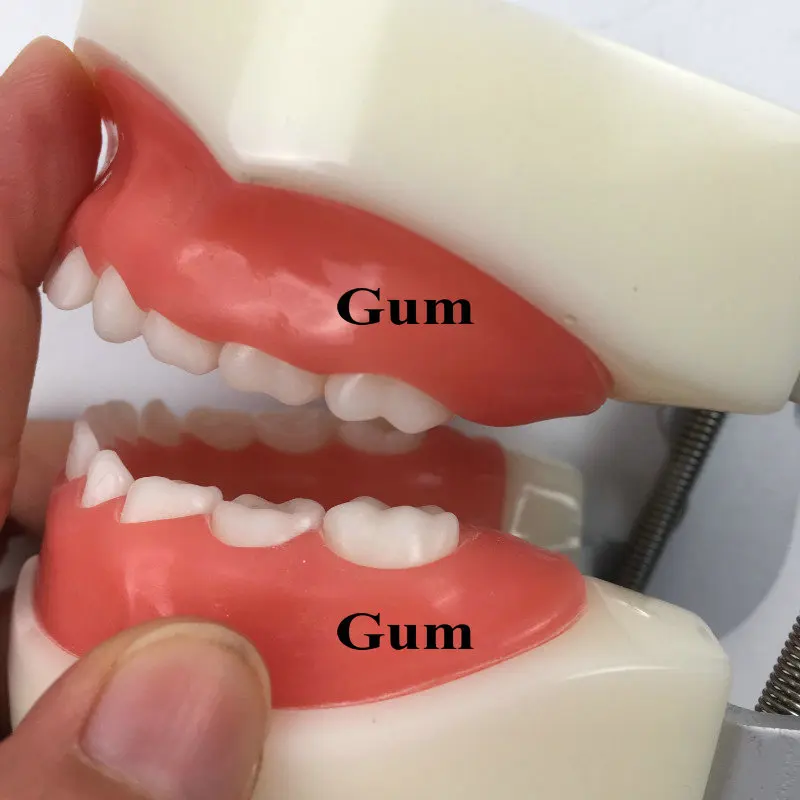 

1 set upper and lower gums for Child teeth