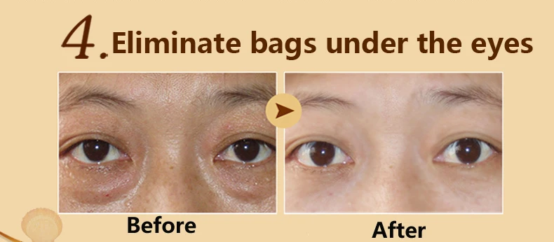 60pcs=30packs Beauty Gold Crystal Collagen Eye Skin Care Eye Patches for Dark Circles, Puffiness, Wrinkles and Bags Eye Gel