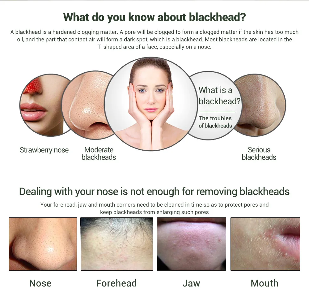 Глубокая чистка удалить угрей Remover маска Blackhead акне маска для уменьшения пор улучшить грубую кожу лечение акне уход за лицом