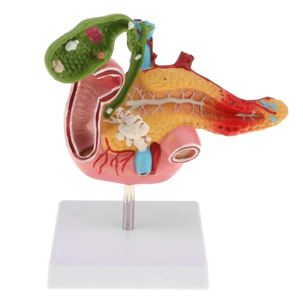 

Human Duodenum Pancreas Pathological Model Structure Medical Anatomical Model for Teaching Tool Learning Display Lab Supplies