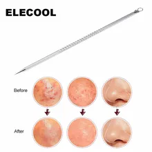 ELECOOL 1 шт. черных точек прыщи акне иглы инструмент с острым носком, ремешком вокруг Уход за лицом Угри экстрактор комедонов акне инструмент для удаления прыщей, инструмент для удаления