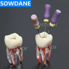 1:1 смоляная Стоматологическая эндодонтическая Студенческая Учебная модель с цветным корневым каналом и целлюлозно-прозрачной без напильников