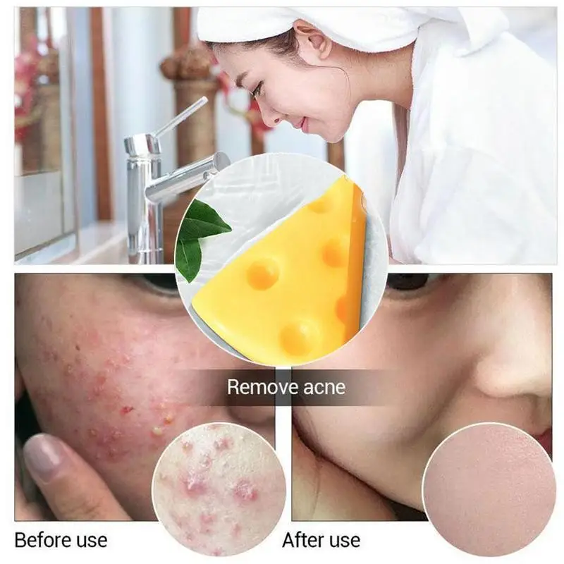 Mini Remove Acne Cheese Facial Soap With Foaming Net Skin Cleansingsoap Cheese Milk Soap Bath Wash Face Soap Refreshing Handsoap Mini Remove Acne Cheese Facial Soap With Foaming Net Skin Cleansingsoap Cheese Milk Soap Bath Wash Face Soap Refreshing Handsoap