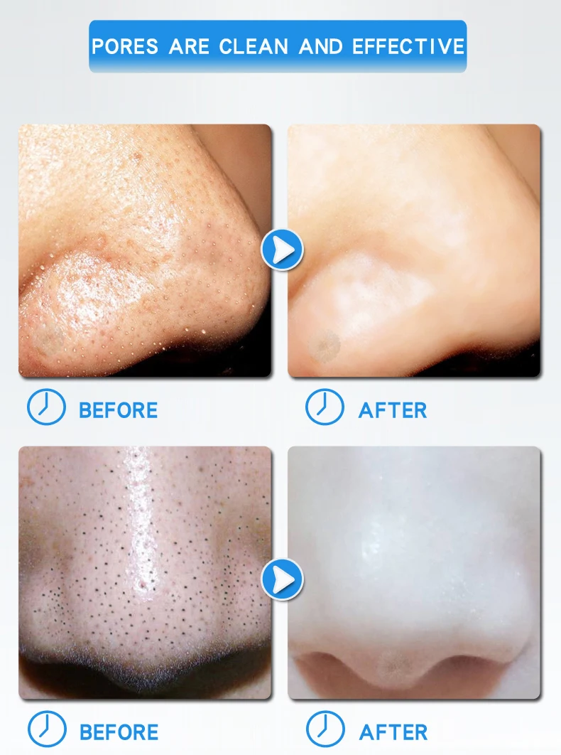 Маска из черных точек маска для лица для уход за лицом для носа Acne Blackhead Black Dots Remover Pore Cleanser Black головная полоска