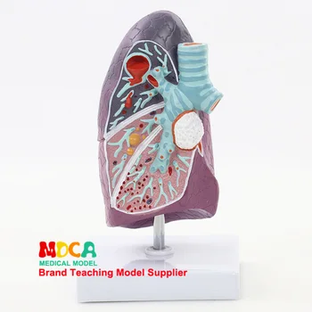 

Human lung Anatomical model Respiratory Department Lung structure Model Medical teaching equipment Manikin