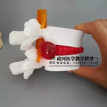 

Medical Human Lumbar Disc Herniation Model Demonstration Model of Lumbar Vertebral Model Orthopedic Model