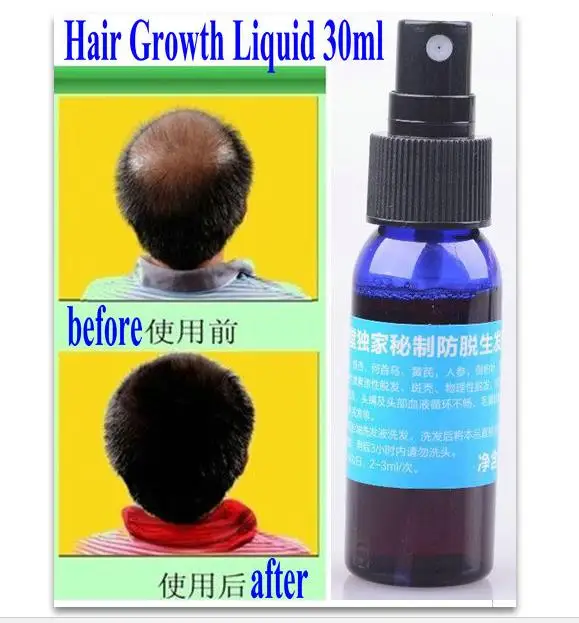1 bottle sunburst hair growth nourishing liquid 30mlbottle, fast hair growth products andrea hair loss treatments