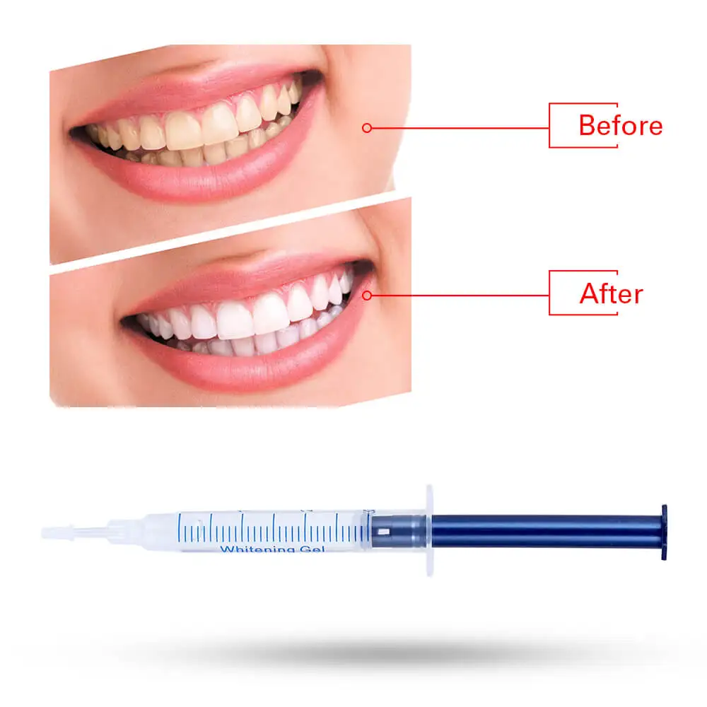 10 гелей 1 светодиодный отбеливатель с белыми зубами для отбеливания горячих зубов, пероксид карбамида, система отбеливания зубов, набор гелей для полости рта 3D, гигиена полости рта
