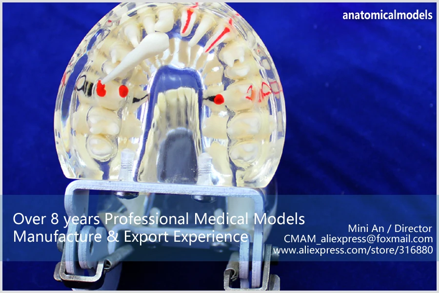 12566/человеческие стоматологические демонстрационные модели пародонтальных кариес, обучение медицине анатомических моделей