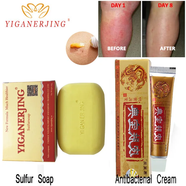 1PC yiganerjing Sulfur Soap add 1PC yiganerjing Anti Bacteria Eczema