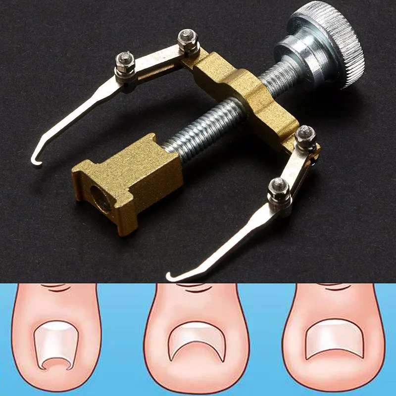 New-Ingrown-Toe-Nail-Correction-File-Corrector-Pedicure