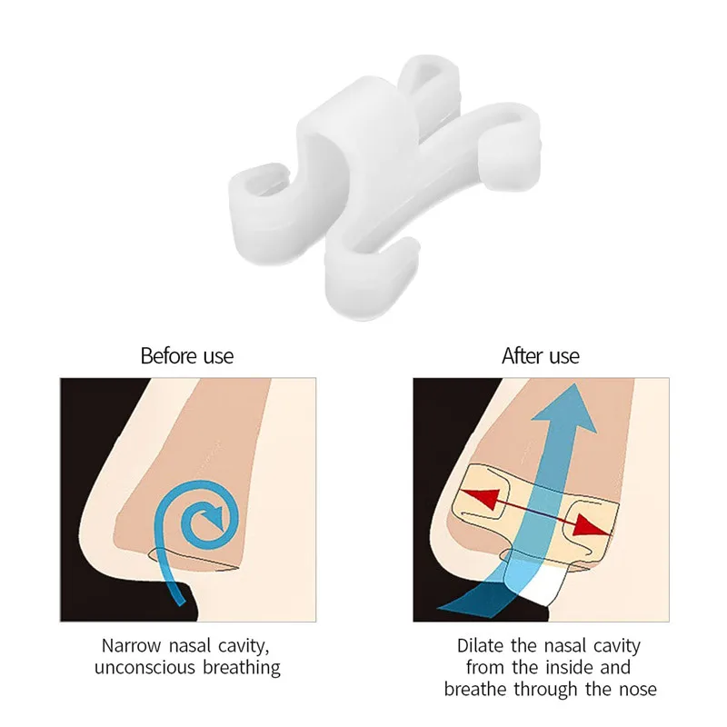 Силиконовый носорасширитель прибор против храпа мини-зажим для носа антихрап устройство для дыхания носом стоп храп защита для сна 35