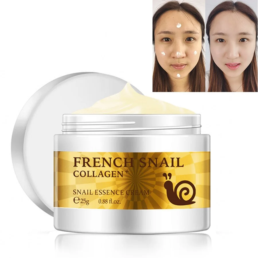 

Brand Snail Face Cream Acne Scar Removal cream For Face Skin Care Whitening Cream Snail Stretch Marks Nourishing For Face