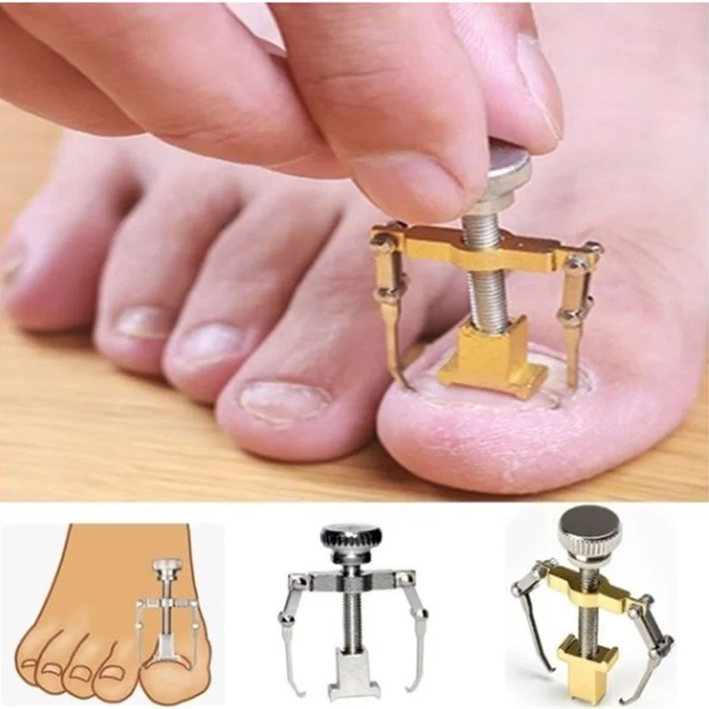 

1Pcs Ingrown Toe Nail Correction Tool Fixer Recover Toe Paronychia Nail Brace Tools Ingrown Toenails Pedicure Tool Dropshipping