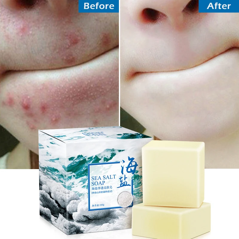 Мыло whitening soap Горячая 100 г морская соль Отбеливающее мыло чистящее средство для удаления прыщей поры, акне терапии козы увлажняющее молочко для очищения лица кожи мыла TSLM1