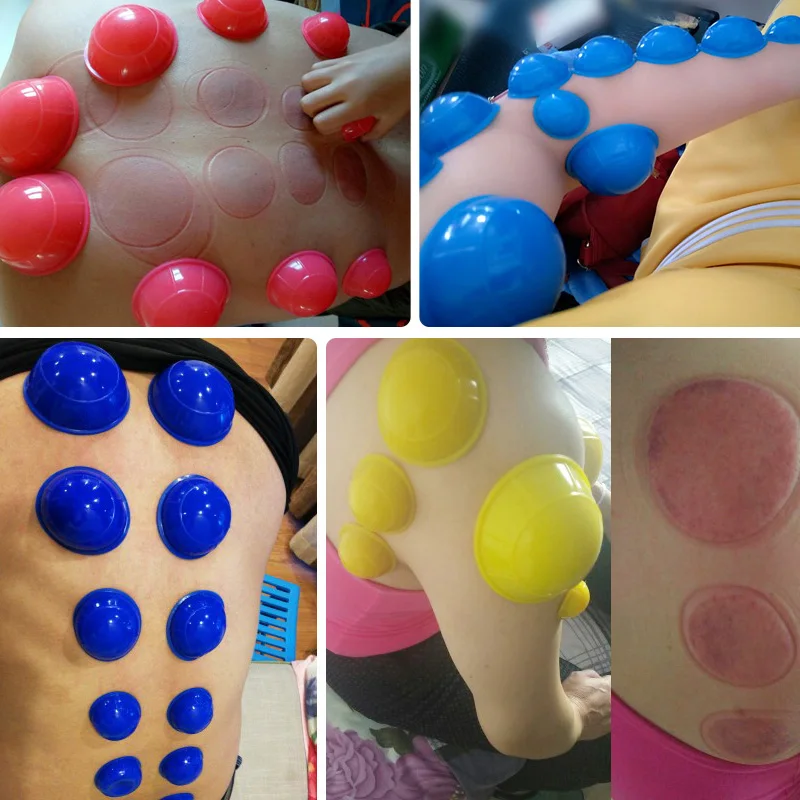 

SHARE HO 12pcs Silicone Massage Jars Cupping Set Chinese Therapy Body Massager Banks Anti Cellulite Vacuum Cans