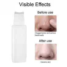 Новая ультразвуковая щетка для кожи лица глубокое очищение шпатель удаление акне чёрных точек кожи лица ухаживающее косметологическое оборудование