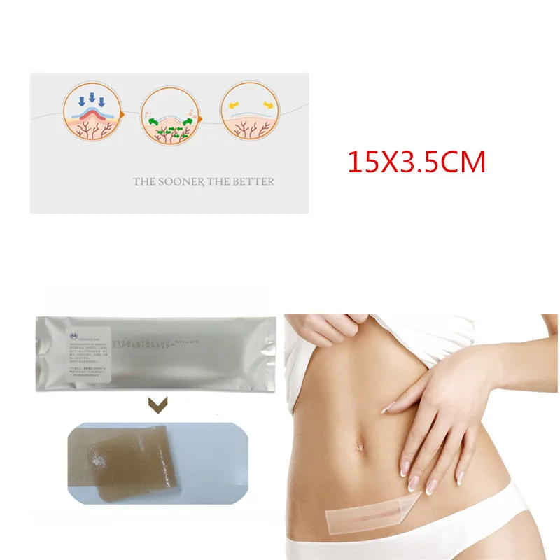

Efficient Silicone Scar Away Patch Cesarean Section Hypertrophic Keloid Scar Removal Sheet Acne Trauma Burn Scar Skin Repairs