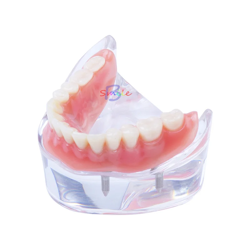 

High quality Dental Teaching Study Overdenture Teeth Model Removable Interior Mandibular Lower Teeth Model