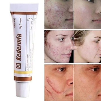 

5g Vietnam Skin Cream Original Snake Oil Moisturizing Hand Cream Acne Scar Treatment Cream For Body Face Skin Repair Cream SK88
