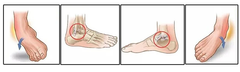 Lace Up Ankle Brace-2