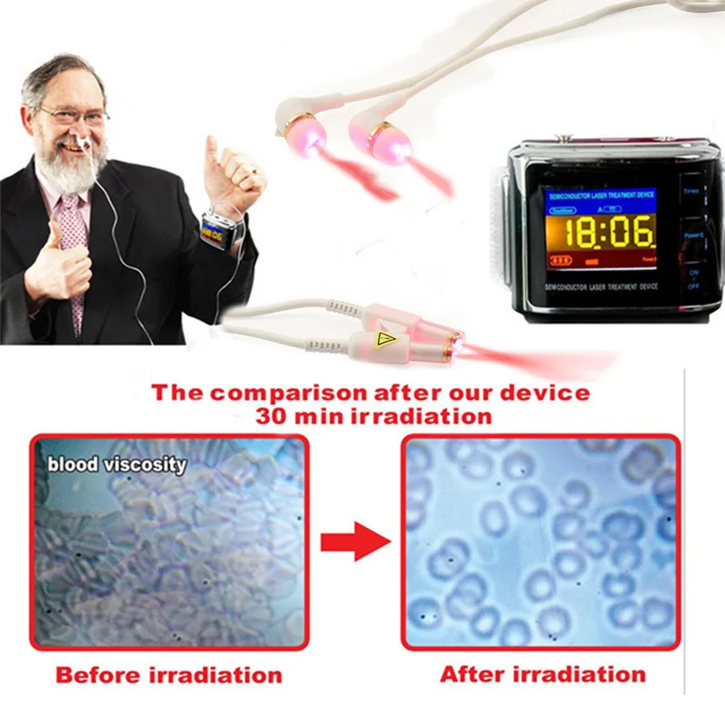 

New Medical Laser Watch Acupuncture Therapy Tinnitus Rhinitis Diabetic Varicose Vein High Blood Pressure Cerebrovascular Disease