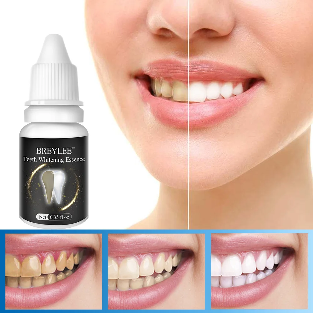 BREYLEE 10 ml Teeth Whitening Solution Remove Black Tooth Yellow Tooth Tooth Tobacco Tea Stains Teeth Care