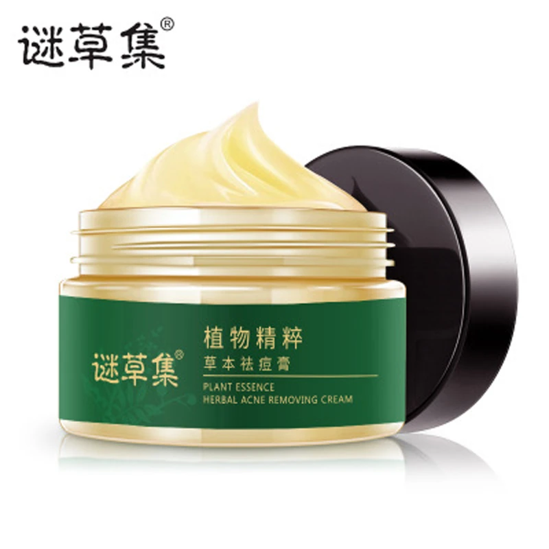 acnes cream oil control