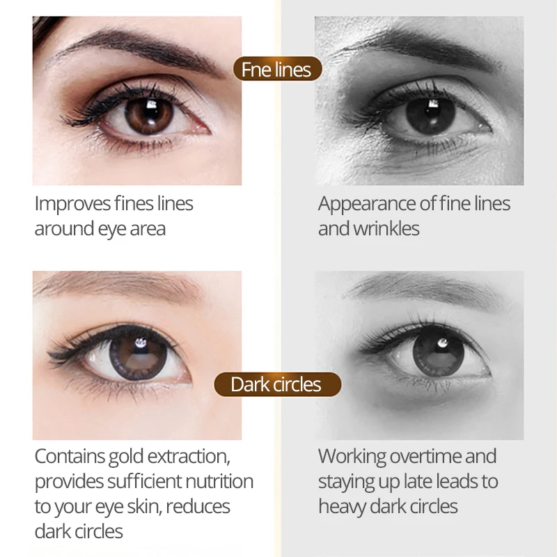 IMAGES Golden eye cream Anti-Puffiness Remove Wrinkles  Dark Circle  Hyaluronic Acid Eye Patches Skin Care Moisturizing