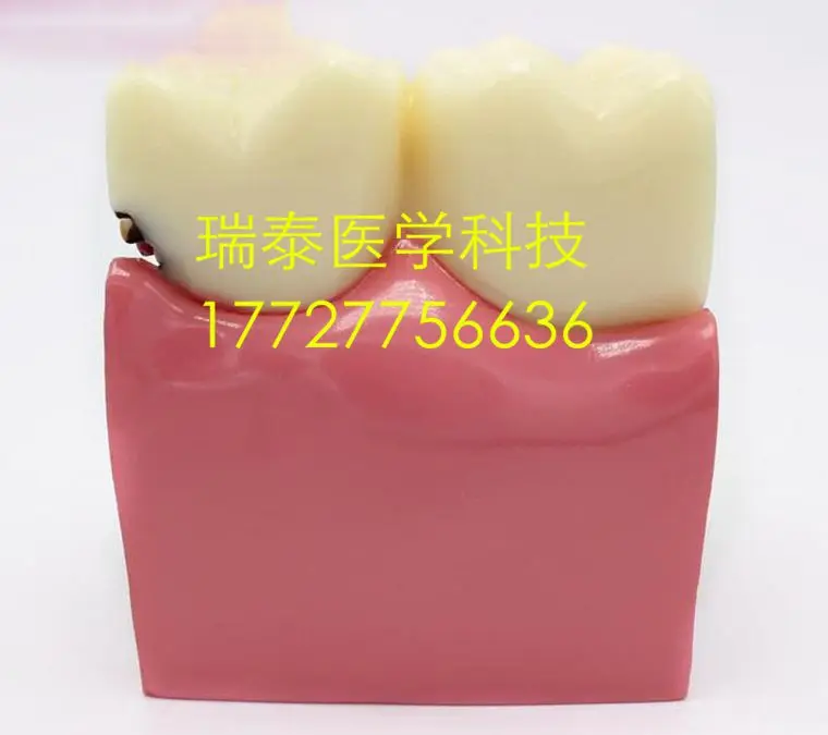 20170904_151438_004