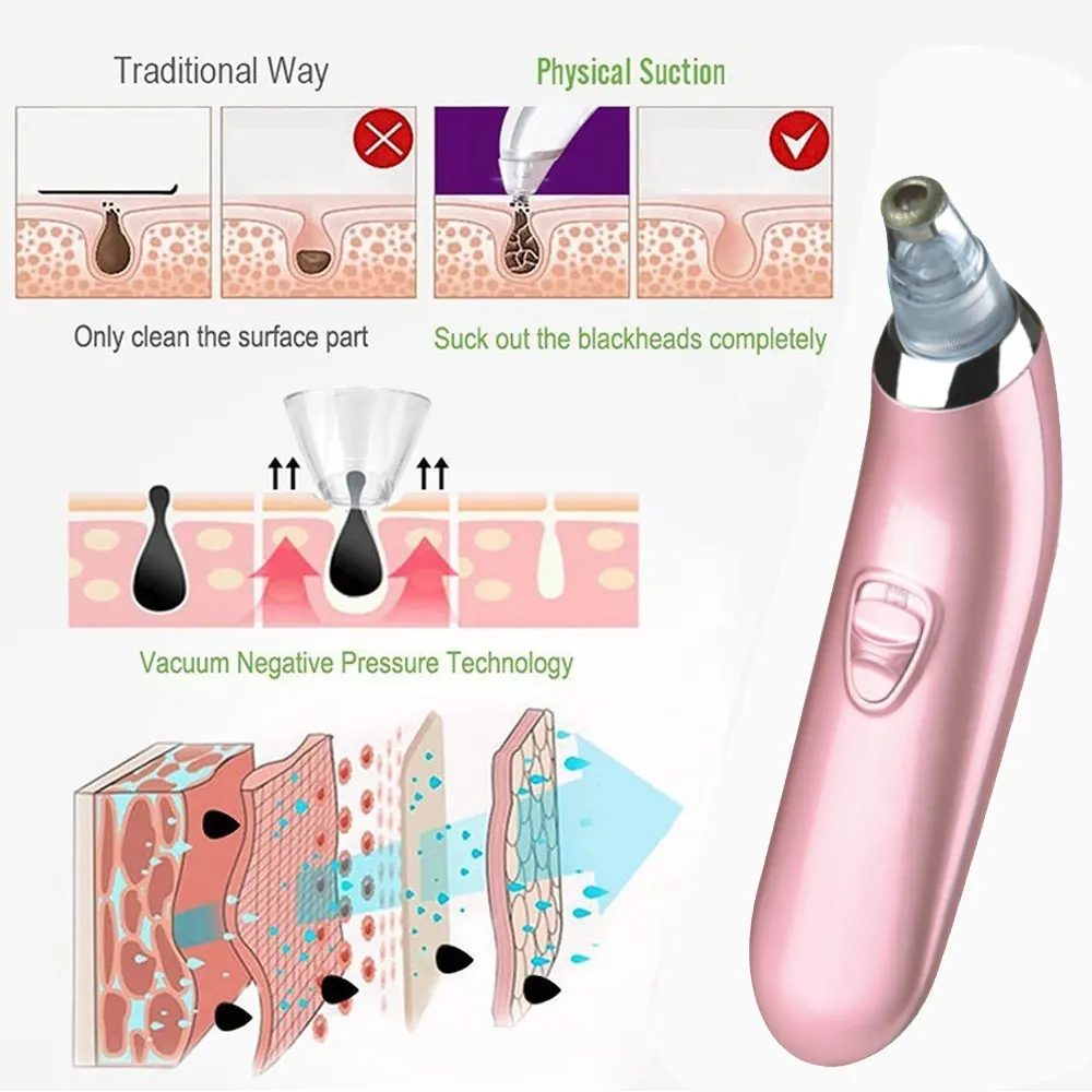 Уход за лицом для пор и угрей очиститель для удаления Вакуумный Очиститель пор Удаление угрей алмазное абразивное удаление дефектов кожи