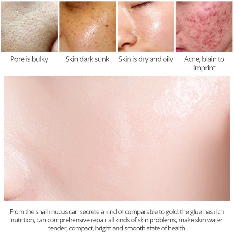 100% растительный экстракт Сыворотка для лица жидкость с гиалуроновой кислотой отбеливание пятна essence Mosturizing Anti-acne