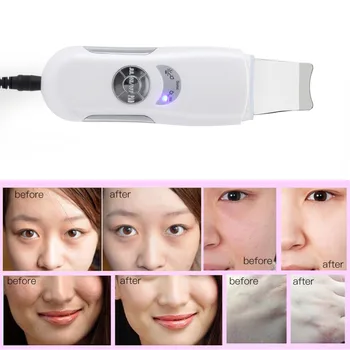 

Ultrasonic Skin Scrubber Cleaner Acne Removal Facial Spa Face Cleaning Massage Ultrasound Vibration Peeling Massage Machine Rohs