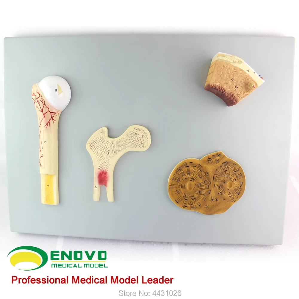 ENOVO Bone structure model vascular cancellous bone and femur haver system human. skeleton цена ENOVO Bone structure model vascular cancellous bone and femur haver system human. skeleton цены онлайн