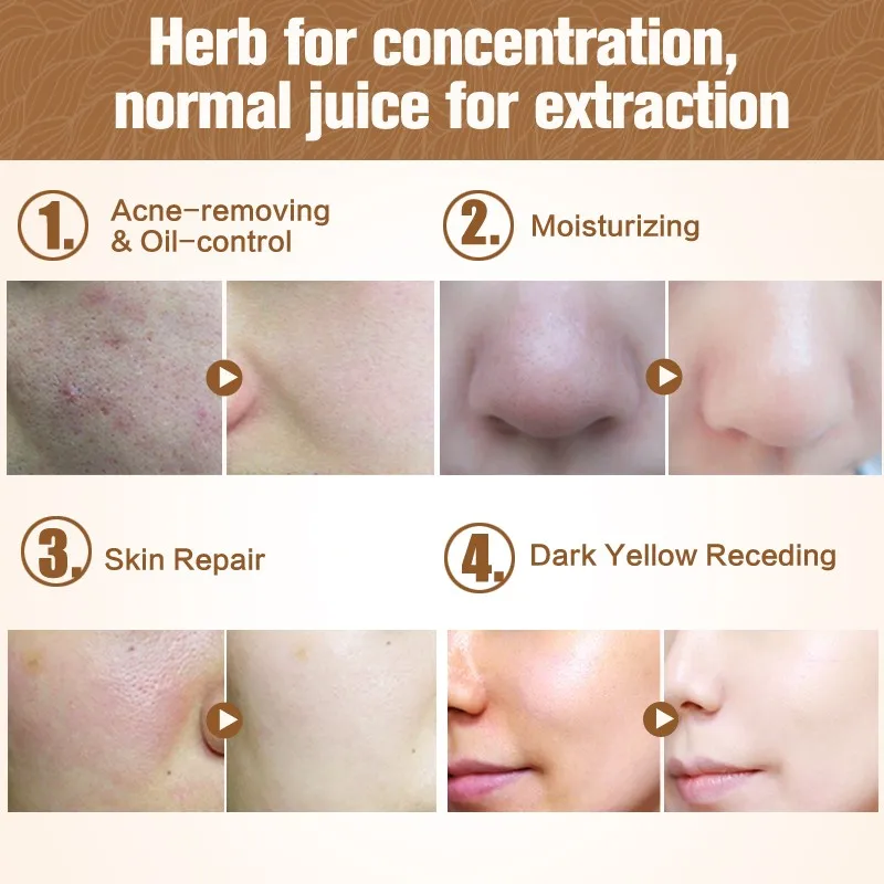 MEIKING-Aloe-Vera-Gel-Day-Creams-120g-Skincare-Moisturizing-Women-Face-Cream-Promotion-Skin-Care-Products (3)