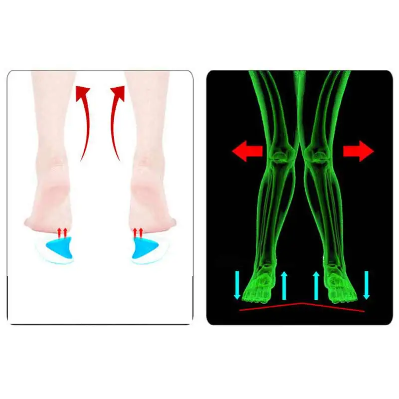 1 пара стельки, поддержка супинатора, силиконовые гелевые стельки на высоком каблуке, здоровая подушка для ног, корректор плоскостопия, облегчение боли в ногах, инструмент для ухода за ногами