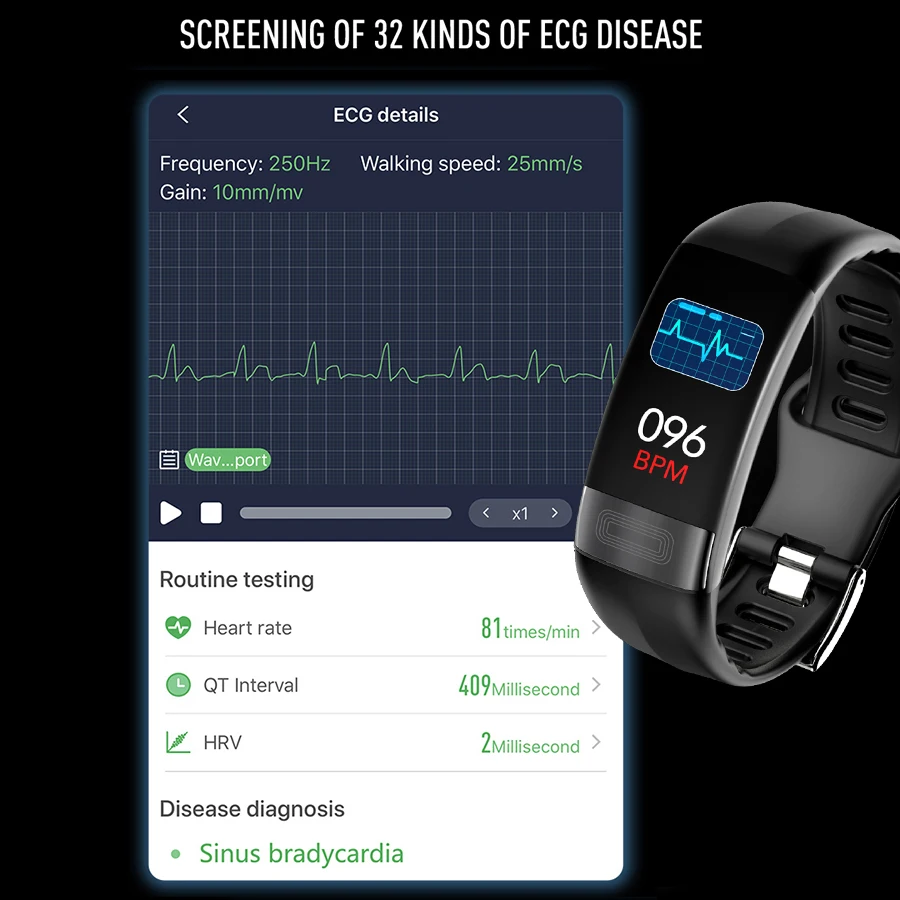  Vwar P11 ECG+PPG Smart Band Blood Pressure HR Monitor Smartband Fitness Tracker Watch Pedometer Sma - 33000630359