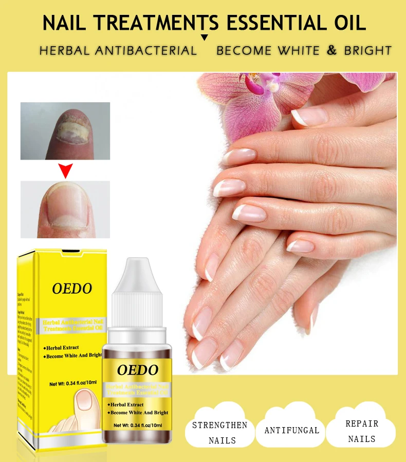 10ml Bactericidal Essence Oil Liquid Nail Repair Treatment Nail Toe Essential Oils Fungal Nail Treatment Nail Care Tools TSLM2